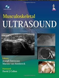 Musculoskeletal Ultrasound