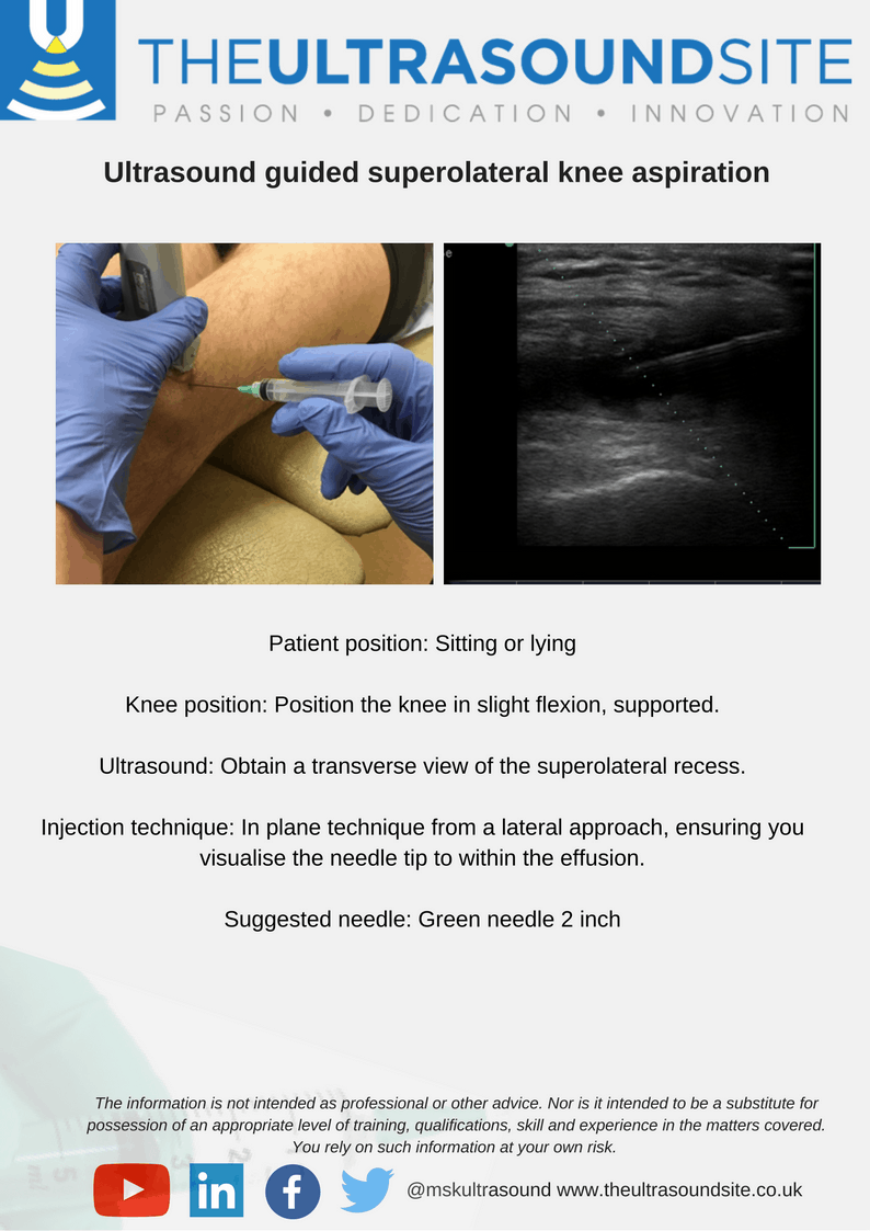 Knee Arthrocentesis Landmarks