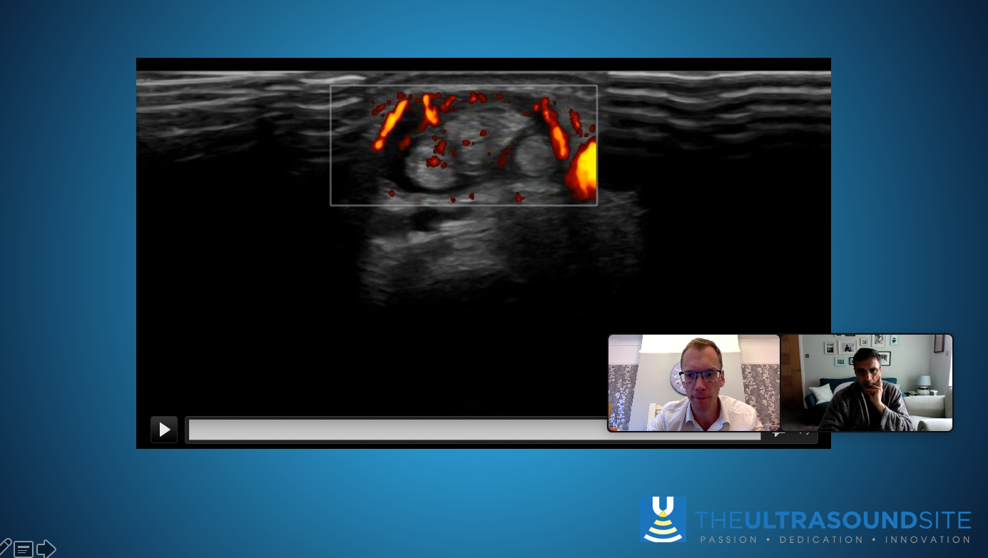 Virtual musculoskeletal ultrasound mentor